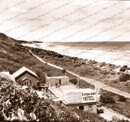 Eastern View Hotel looking towards Aireys Inlet, Victoria. c1920s. Great Ocean Road